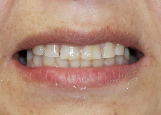 case 27 before