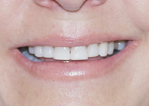 case 27b before