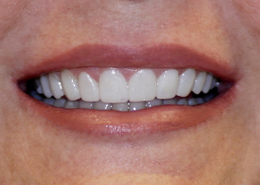 Case 28 after