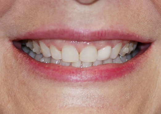 case 28 before