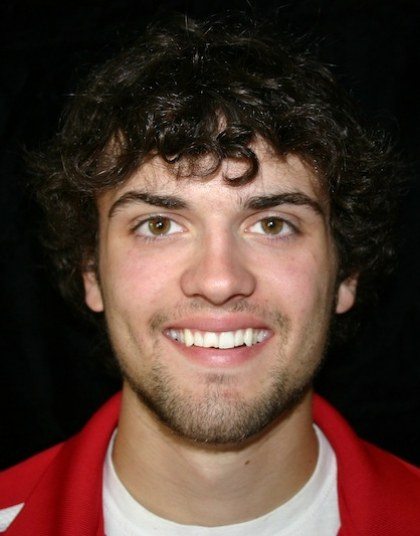 Young man with a chipped tooth before dental treatment in Grand Island