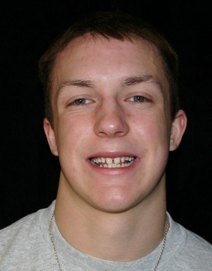 Young man in Grand Island with gapped teeth