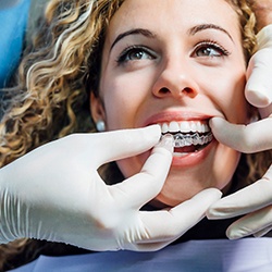 patient getting Invisalign in Grand Island