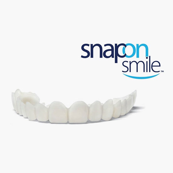 snap on smile