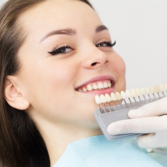 woman smiling with veneer shade chart