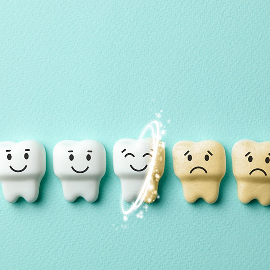 Teeth whitening illustration