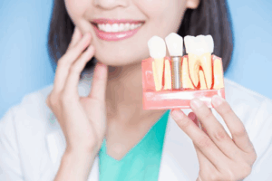 Dentist holding a dental implant model