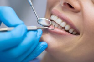 Persona smiling while a dentist checks their teeth